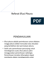 Referat Efusi Pleura