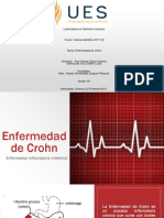 Enfermedad de Crohn