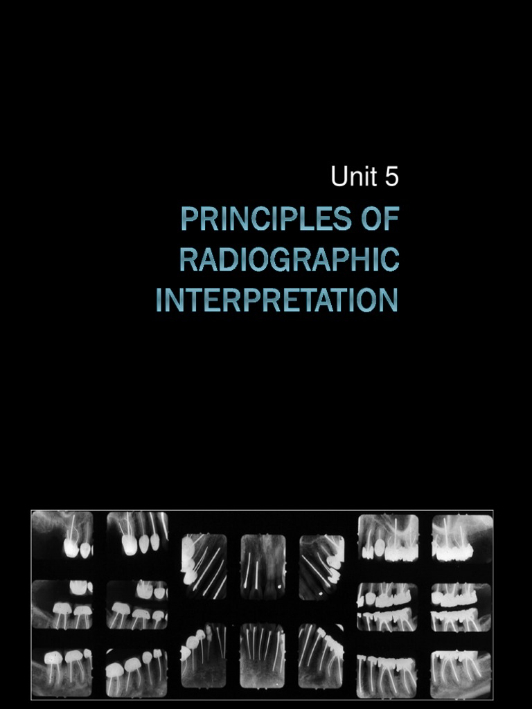 05 Principles of Radiographic Interpretation 08 | PDF | Diseases And ...
