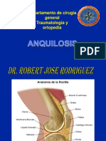 ANQUILOSIS
