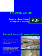 3. Leucemiile Acute