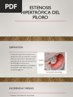 ESTENOSIS HIPERTRÓFICA DEL PÍLORO.pptx