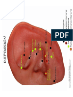 DEPRESION AURICULO