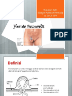 Hernia Femoralis