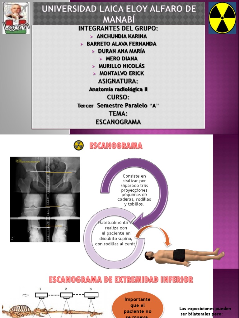Escanograma de Miembros Inferiores | PDF | Sistema musculoesquelético ...