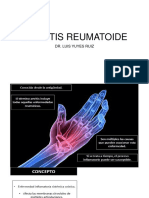 Artritis Reumatoide