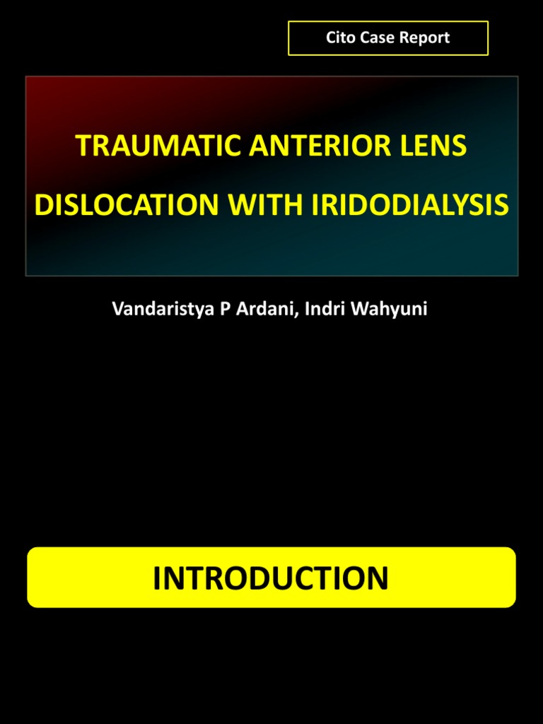 traumatic anterior lens dislocation with iridodialysis Vision Eye