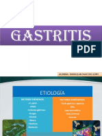 Gastritis Aguda y Crónica