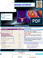 Embarazo Ectópico 