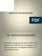 Artritis Reumatoide Con Criterios Nuevos