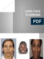 Long Face Syndrome