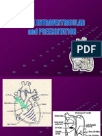 ECG, Block Intraventricular, Preexcitation