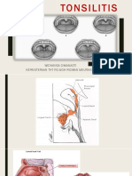 Tonsilitis