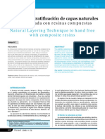 Tecnica_de_estratificacion_de_capas_natu.pdf