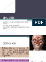 Sinusitis