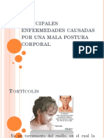 principalesenfermedadescausadasporunamalaposturacorporal-110105234203-phpapp01 (1).pptx
