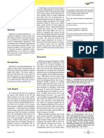 2011 Ulcerated Cutaneous Epithelioid Hemangioendothelioma in An 8-Month Old Infant