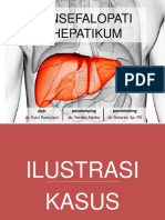 Ensefalopati Hepatikum - Putri Pamulani