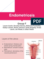 Endometriosis 2