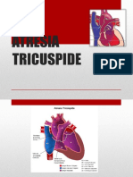 Atresia Tricuspid e