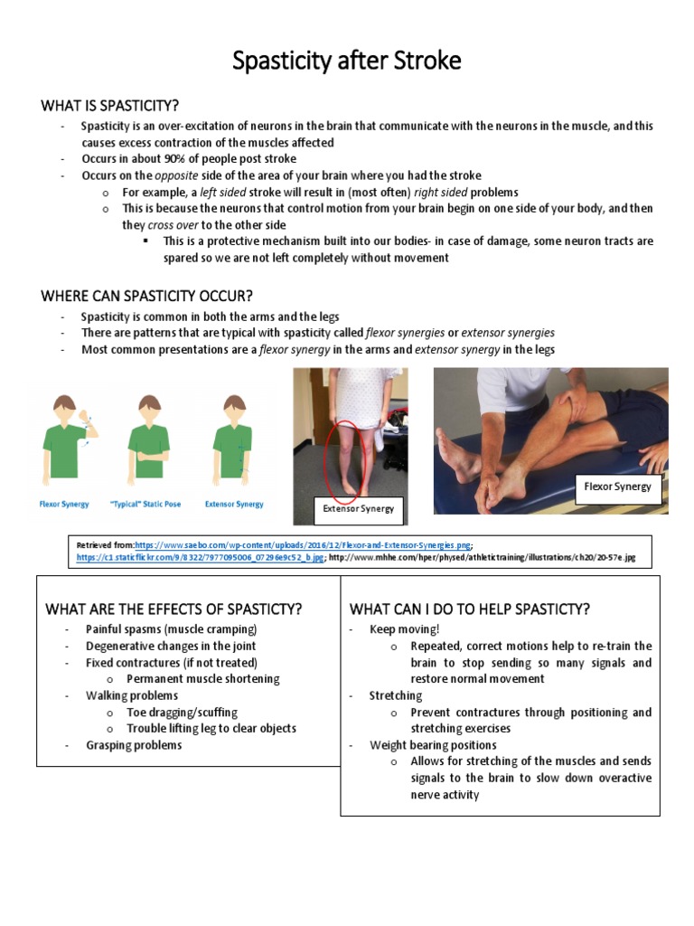 Understanding Stroke Spasticity Patterns | PDF | Dance Science ...