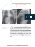 Pneumoperitoneum: Images in Clinical Medicine