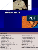 Incidence, Causes, and Management of Hepatocellular Carcinoma