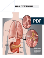 Anatomy of Cystic Fibrosis