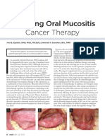 Managing Oral Mucositis Oral Health July 2015