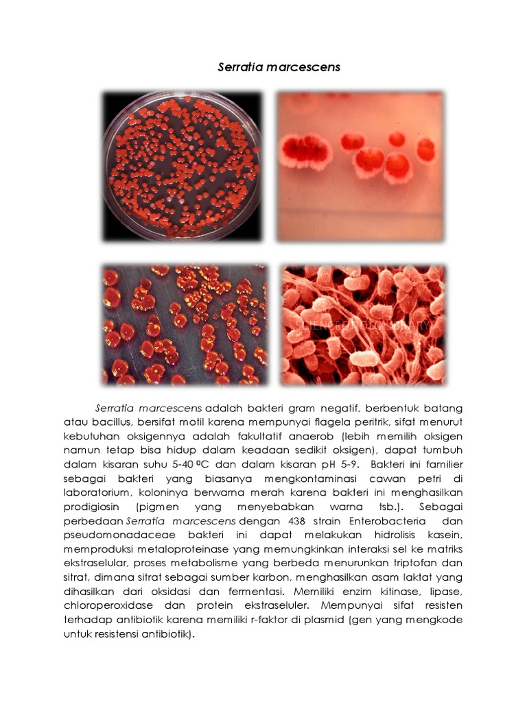 Serratia Marcescens PDF