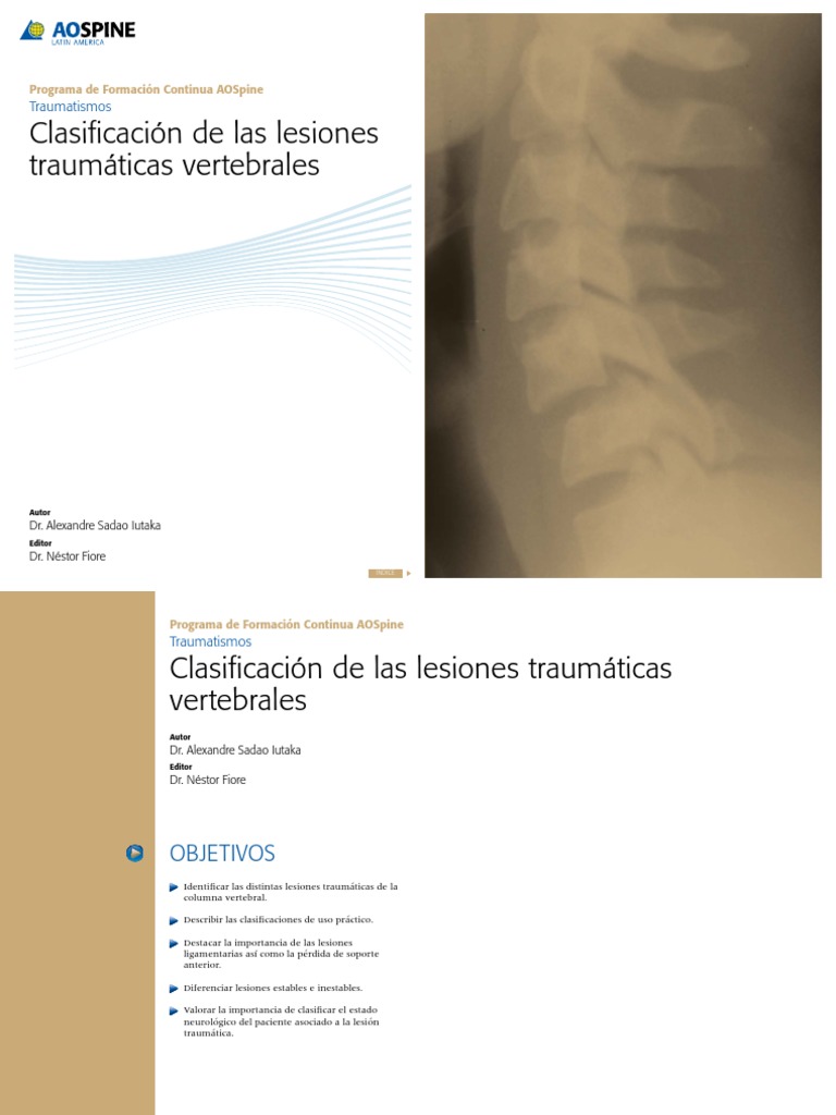 AOSpine CLSFFXVRT | PDF | Lesión | Sistema musculoesquelético