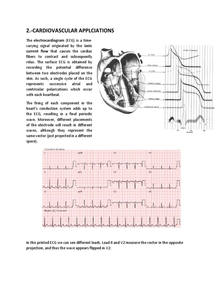 ECG Signal Processing Techniques | PDF | Electrocardiography | Spectral ...