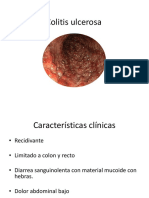 Colitis ulcerosa.pptx