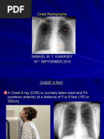 Download Plain Chest X Ray by Samuel Gamadey SN37786341 doc pdf