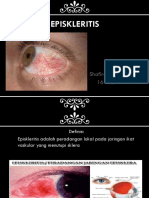 EPISKLERITIS