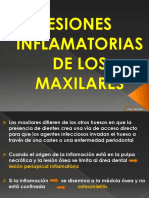 Lesiones Inflamatorias de Los Maxilares PDF