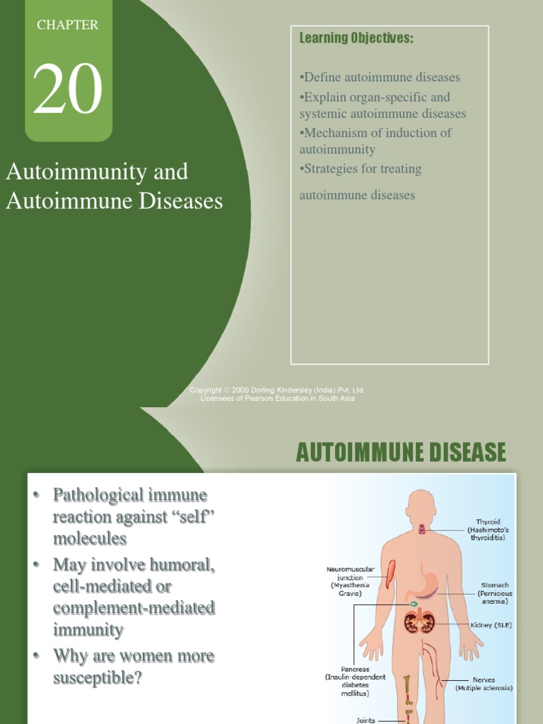Autoimmunity and Autoimmune Diseases | PDF | Autoimmunity | Autoimmune ...