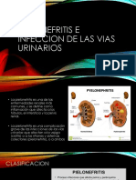 Pielonefritis e Infeccion de Las Vias Urinarios