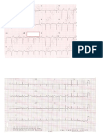 Ecg