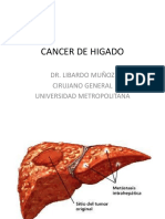 Cancer de Higado