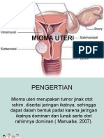 MIUMA UTERI