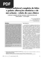 Fissura unilateral completa de lábio e palato: