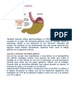 Cómo Tratar El Reflujo Gástrico