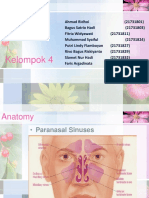 Sinusitis