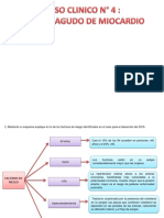 Caso Clinico #4 Infarto Agudo de Miocardio