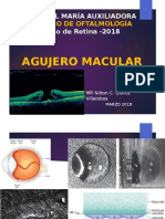 Agujero Macular