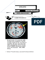 Epilepsi (Screening)