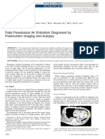 2012fatal Air Embolism Proven by Postmortem Imaging