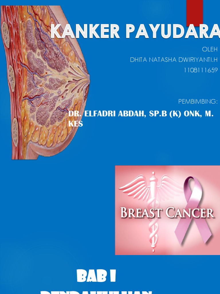 KANKER PAYUDARA dhita.pptx