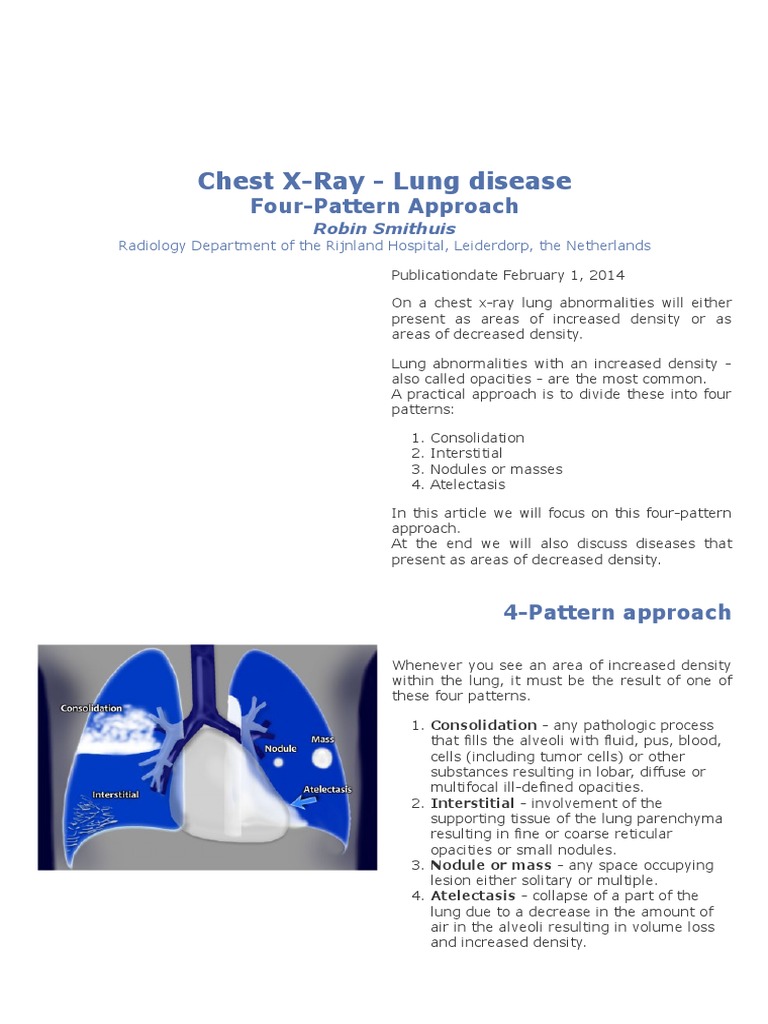 Chest X-Ray: Four Patterns of Lung Density | PDF | Pneumonia | Lung